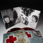 Fix Me 20th Anniversary 2LP Vinyl (Red & Black Marble Vinyl)